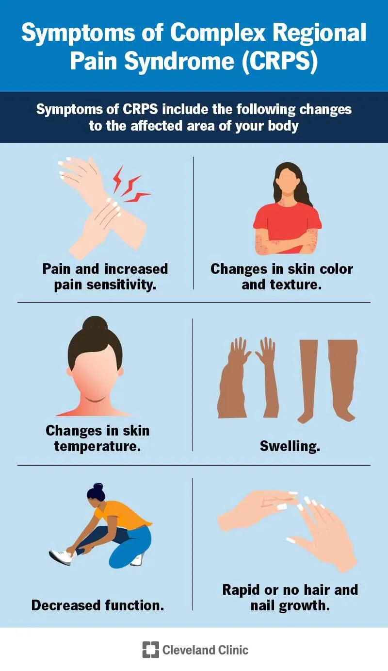 12085-complex-regional-pain-synd