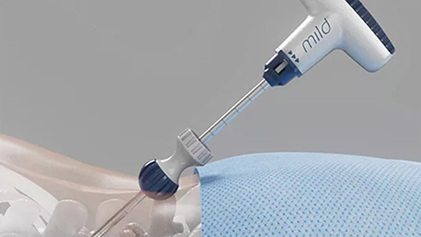mild-shot-treatment